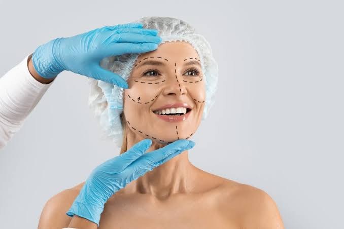 Marcação cirúrgica no rosto antes de um procedimento de lifting facial