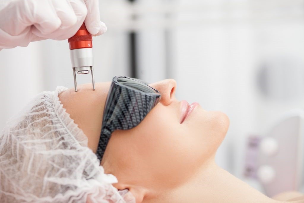 Paciente em sessão de peeling e laser facial